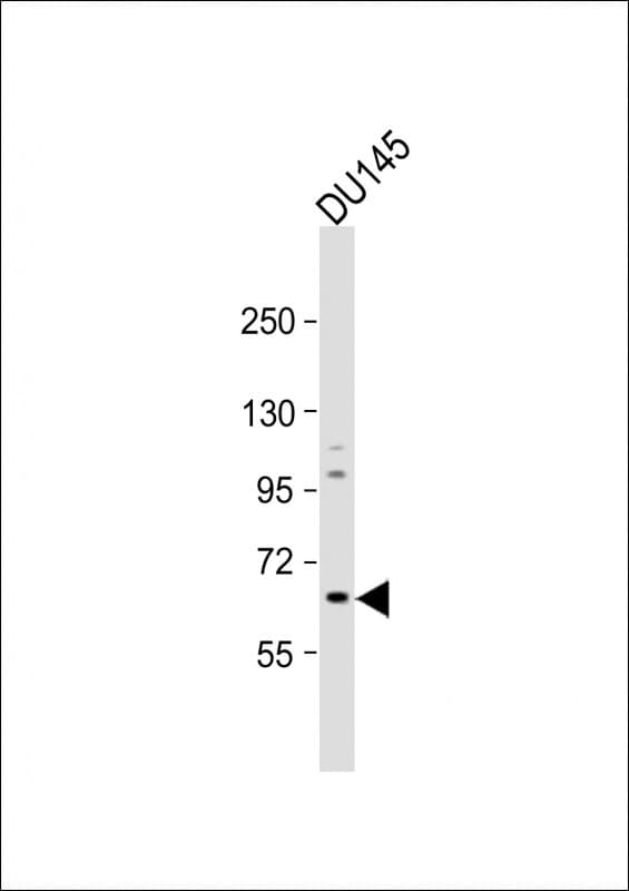 IHC-plus™ GALNT9 Antibody (aa296-322)