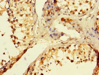 Polyclonal Rabbit anti-Human POLB / DNA Polymerase Beta Antibody