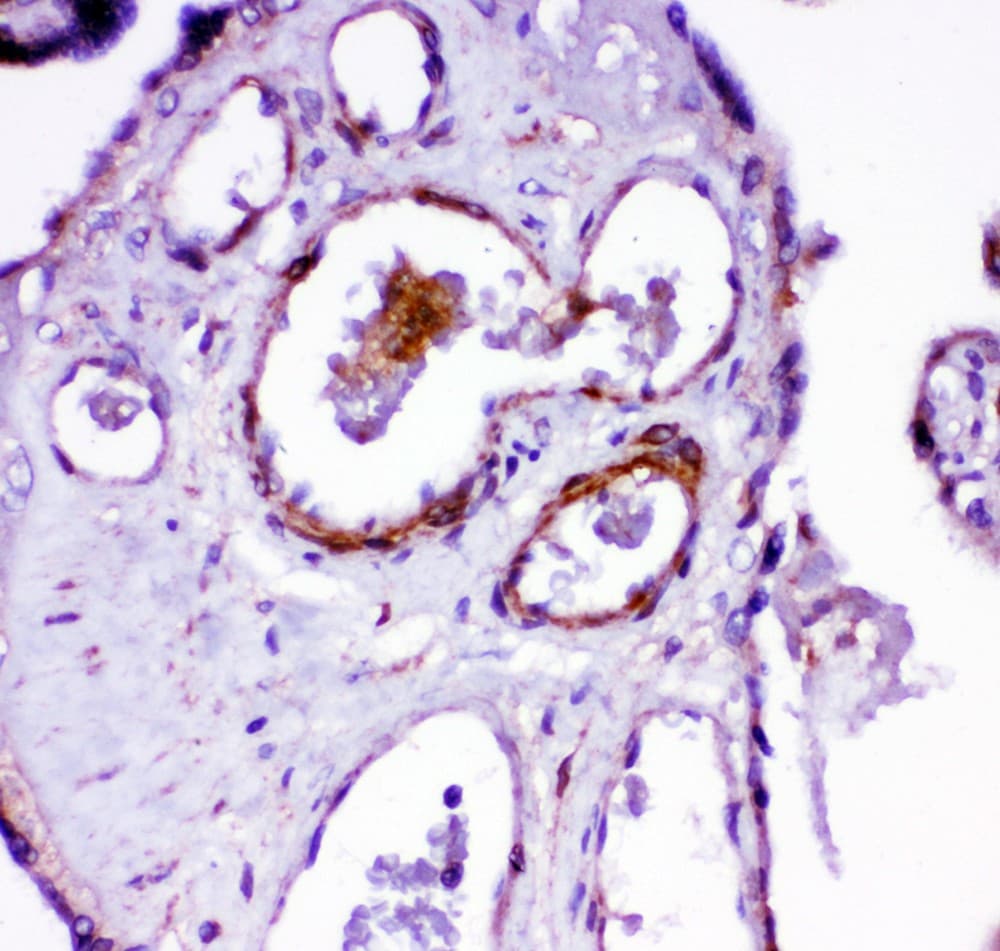 ACE / CD143 Antibody (aa702-715)