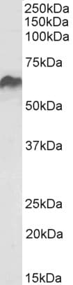 PathPlus™ HSPD1 / HSP60 Antibody