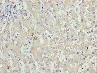 KHDC1 / C6orf148 Antibody
