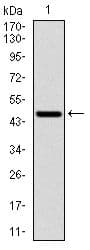 RPS6KB1 / P70S6K / S6K Antibody (clone 5G9)