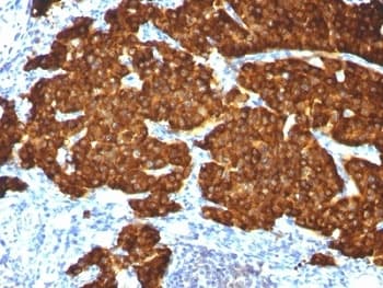 CHGA / Chromogranin A Antibody (clone CGA/413 + CHGA/777 + CHGA/798, Ready-to-Use)