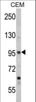 SEMA3A / Semaphorin 3A Antibody (aa535-566)