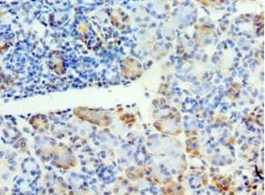 SYT4 Antibody (aa38-190)