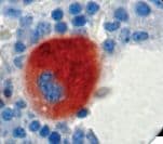 ITGB3 / Integrin Beta 3 / CD61 Antibody (clone 2f2)