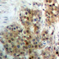 Polyclonal Rabbit anti-Human MAPK15 / ERK7 Antibody (phospho-Thr175/Tyr177, IHC, WB)