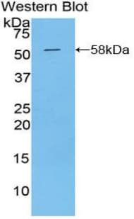 KLK6 / Kallikrein 6 Antibody (aa26-261)
