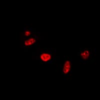 RAD17 Antibody (C-Terminus)