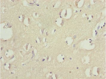 TNRC5 / CNPY3 Antibody