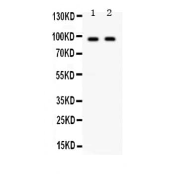 KIAA1524 / p90 Autoantigen Antibody (aa854-889)