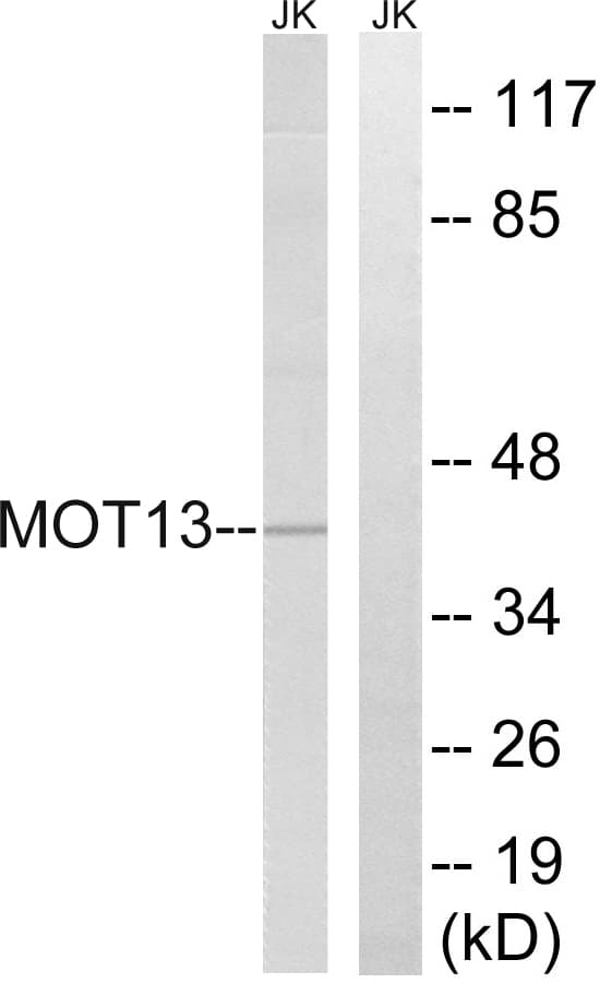 SLC16A13 Antibody (aa377-426)