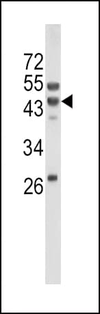 WNT10B Antibody (aa193-222)