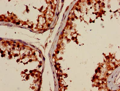 Polyclonal Rabbit anti-Human POLI Antibody (IHC, IF)