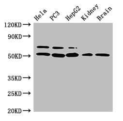 NR5A2 / LRH-1 Antibody