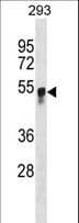 GCNT3 Antibody (aa73-102)