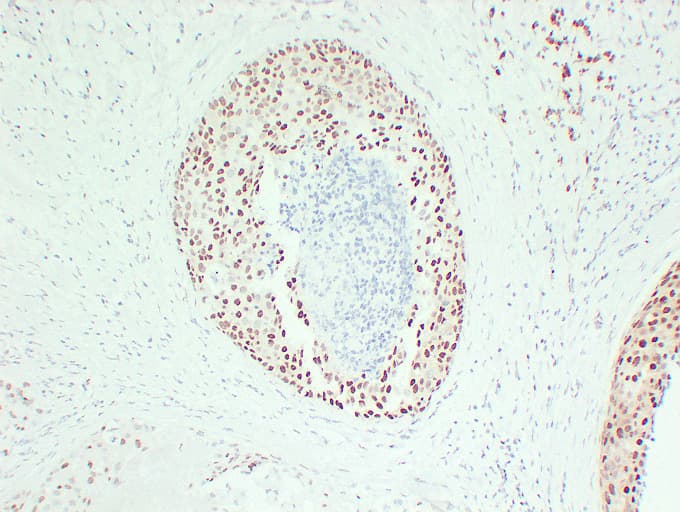 ER Alpha / Estrogen Receptor Antibody (clone ABT-ER)