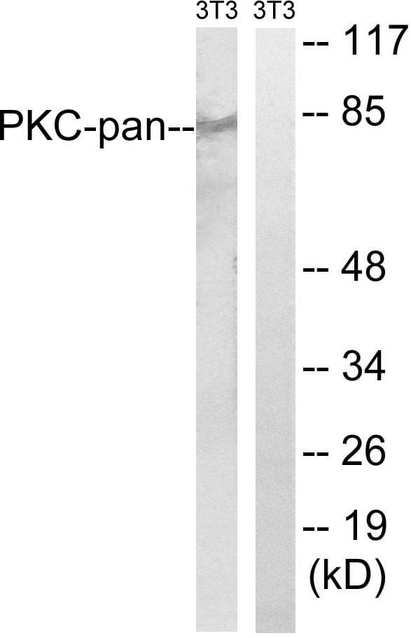 PKC / Protein Kinase C Antibody (phospho-Thr497)