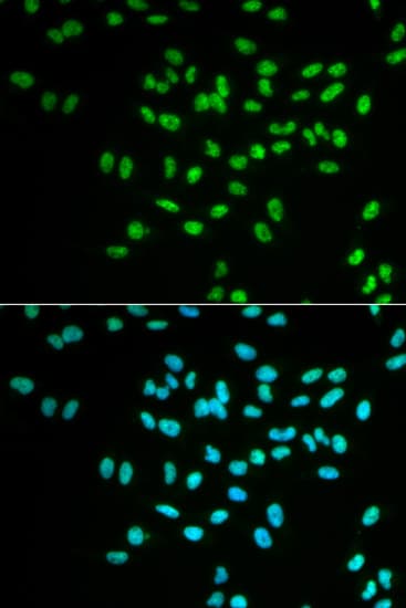 FANCD2 Antibody