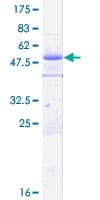 Human ZC3HC1 / NIPA Protein (Recombinant GST)