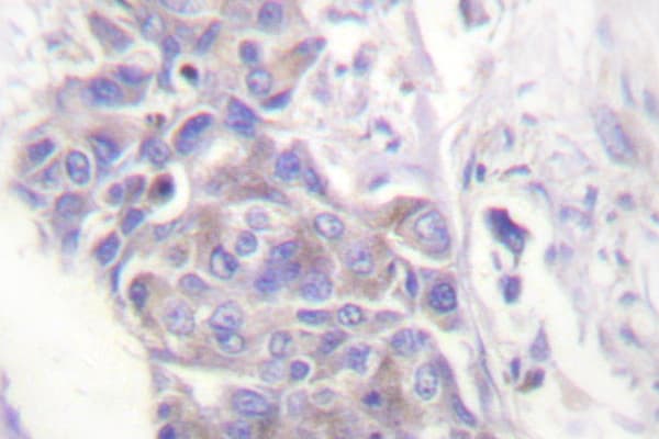 TXNRD2 Antibody (Ser501)