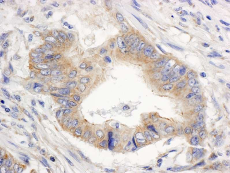 SPTAN1 / Alpha Fodrin Antibody (aa1000-1050)