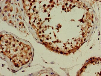 MAP1LC3B / LC3B Antibody