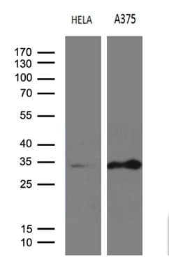 RPAIN Antibody (clone OTI6A7, Carrier-free)
