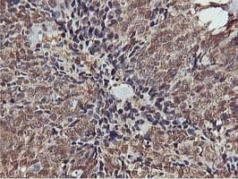 AKT1 Antibody (clone OTI3E3)