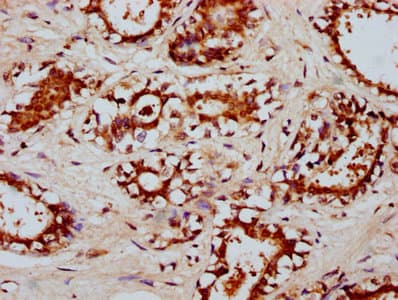 Polyclonal Rabbit anti-Human RYK Antibody (IHC, WB)