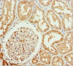 PPP1R8 / Rnase E Antibody