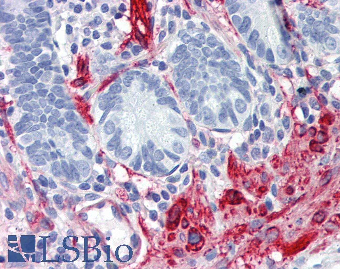 IHC-plus™ FLNA / Filamin A Antibody (clone 4E10-1B2)