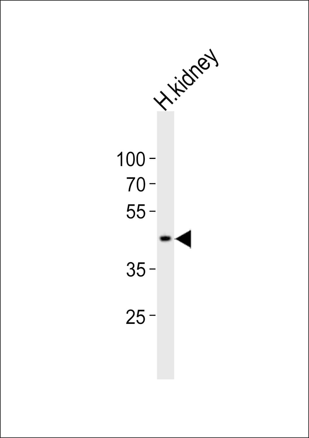 SOX7 Antibody (aa224-258)