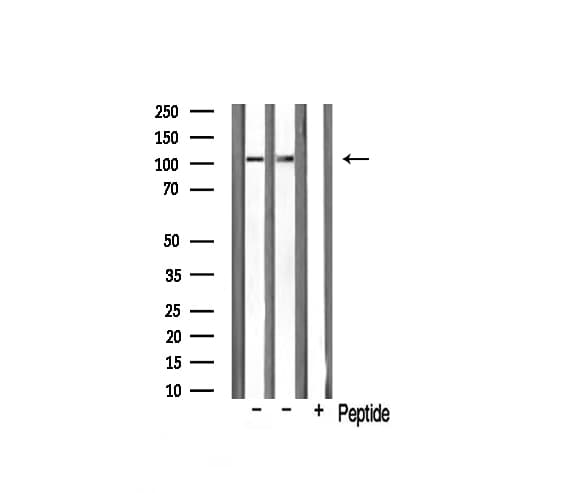 NARG1 / NAA15 Antibody