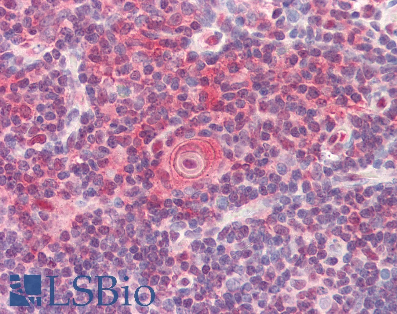 IHC-plus™ UBE2L6 Antibody (aa1-152, clone K1H3)