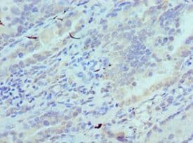 SYNCAM / CADM1 Antibody (aa45-344)