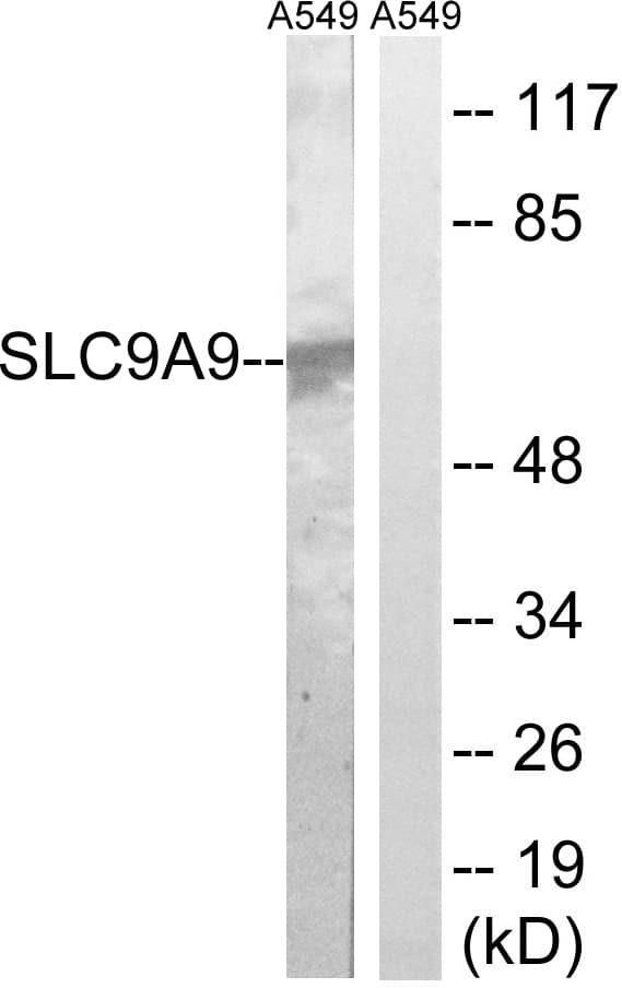 SLC9A9 / NHE9 Antibody (aa171-220)
