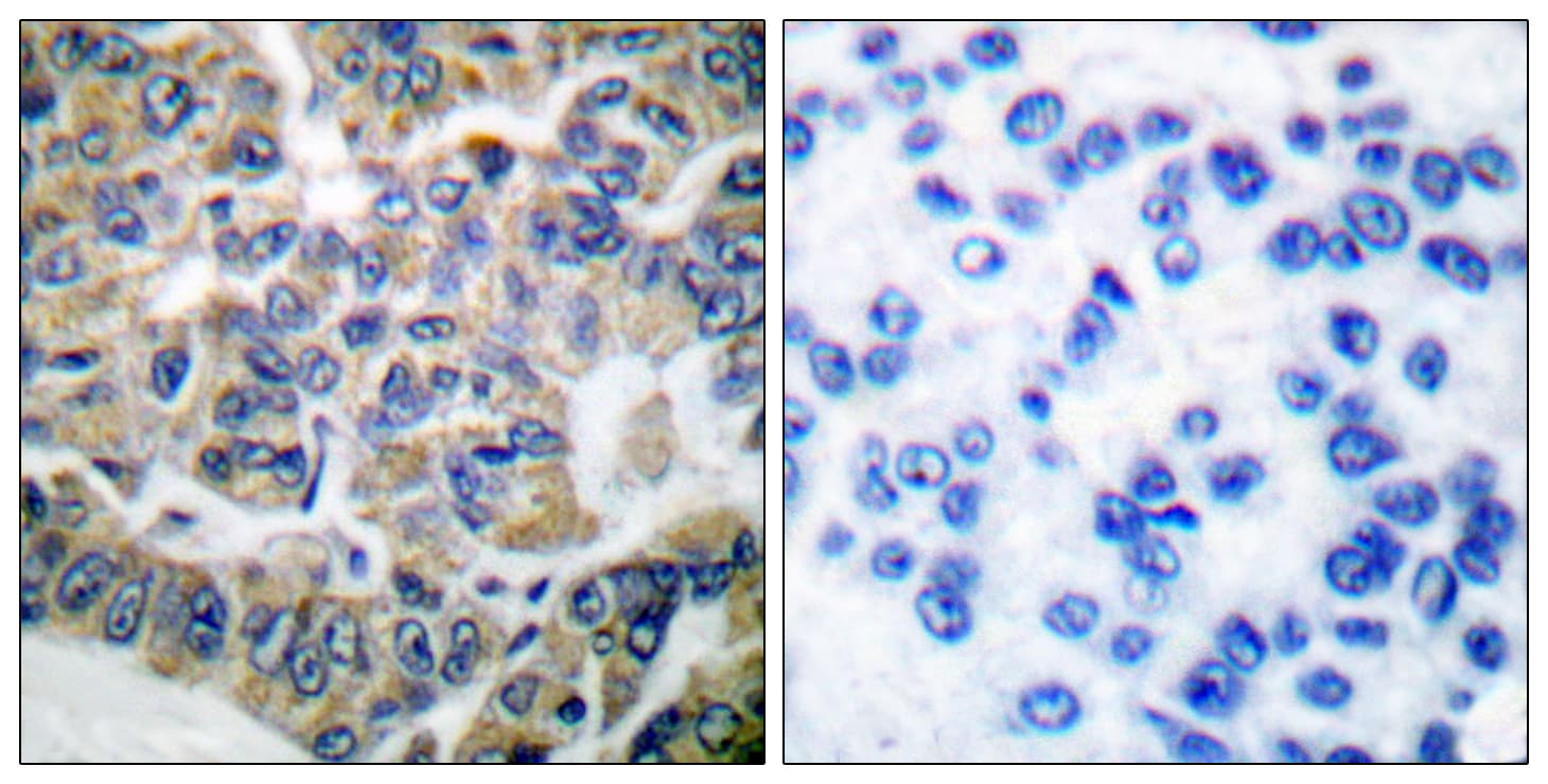 EEF2K Antibody (aa331-380)