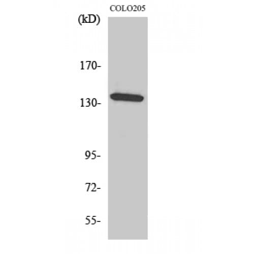 Polyclonal Rabbit anti-Human ALPK1 Antibody (30-110 aa, N-terminal, IHC, IF, WB)