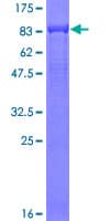 Human Complement C9 Protein (Recombinant GST)