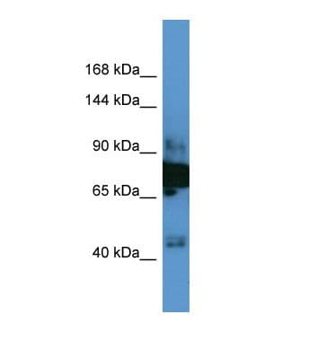 Polyclonal Rabbit anti-Human ELKS / ERC1 Antibody (aa509-558, WB)