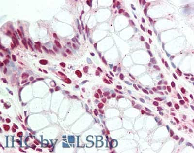 Polyclonal Rabbit anti-Human BLIMP1 / PRDM1 Antibody (C-Terminus, IHC, WB)