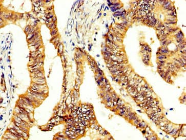 CCKBR / Cckb Antibody