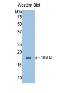RSPO1 / RSPO Antibody (aa136-262, FITC)