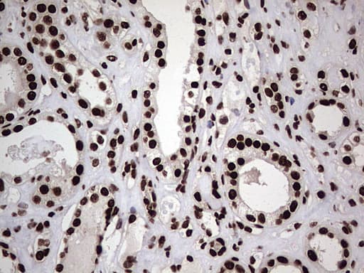 HNRNPL / hnRNP L Antibody (aa270-502, clone OTI9F11, Carrier-free)