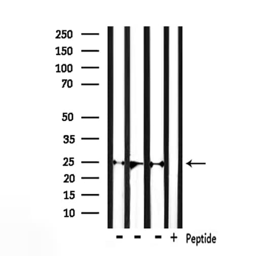 Polyclonal Rabbit anti-Human OPRS1 / SIGMAR1 Antibody (IHC, WB)
