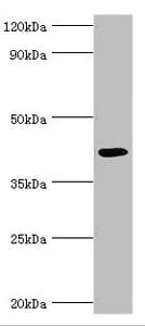 IHC-plus™ ALKBH1 / ALKB Antibody (aa110-389)
