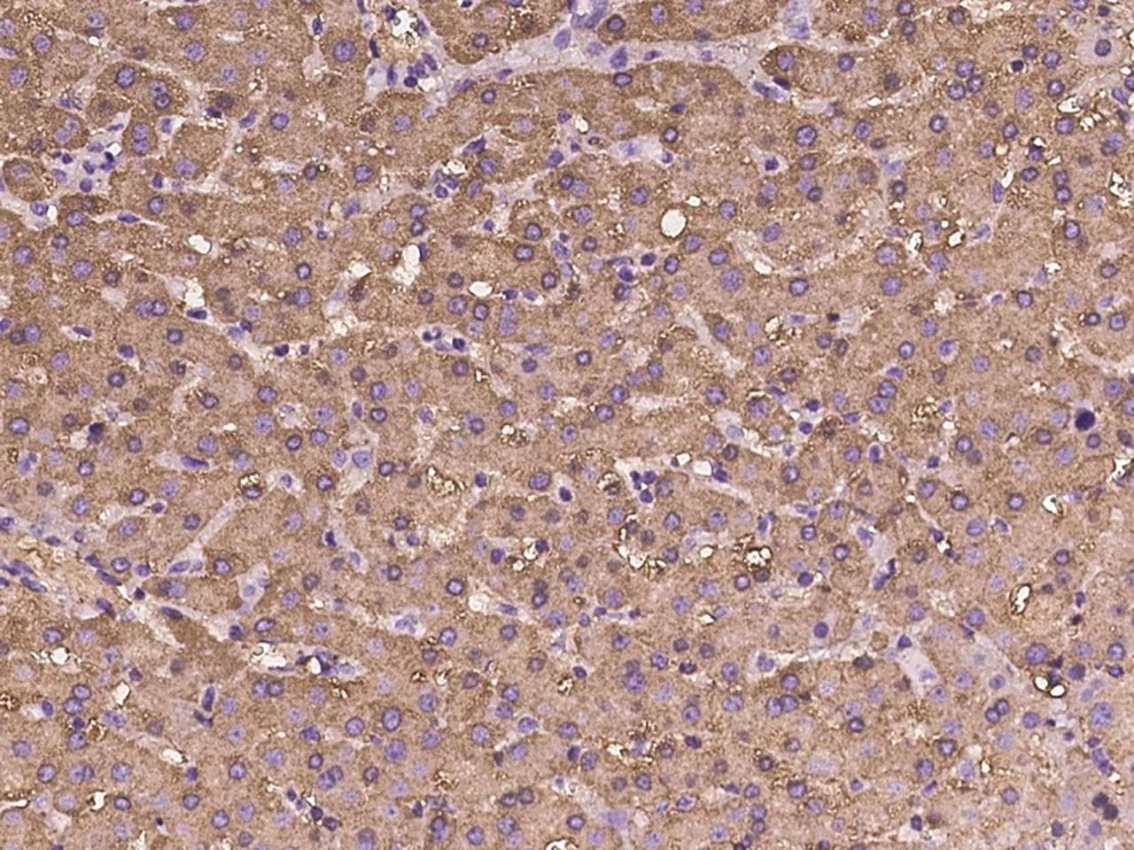FBP1 Antibody