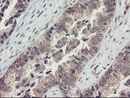 RBPMS / Hermes Antibody (clone OTI2C3, Carrier-free)