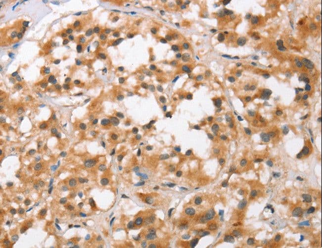 BCAS4 Antibody